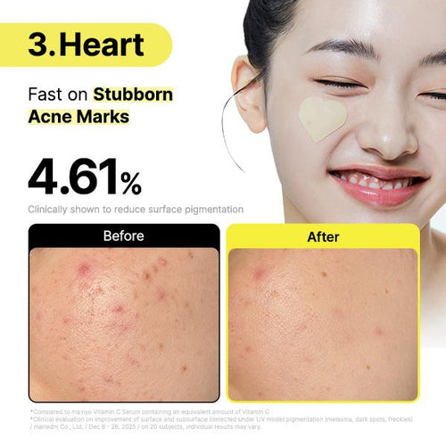 Glutathione 7 Dark Spot Serum Patch