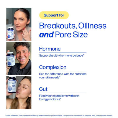 Clear Skin Acne Supplement - Clear Acne From The Source