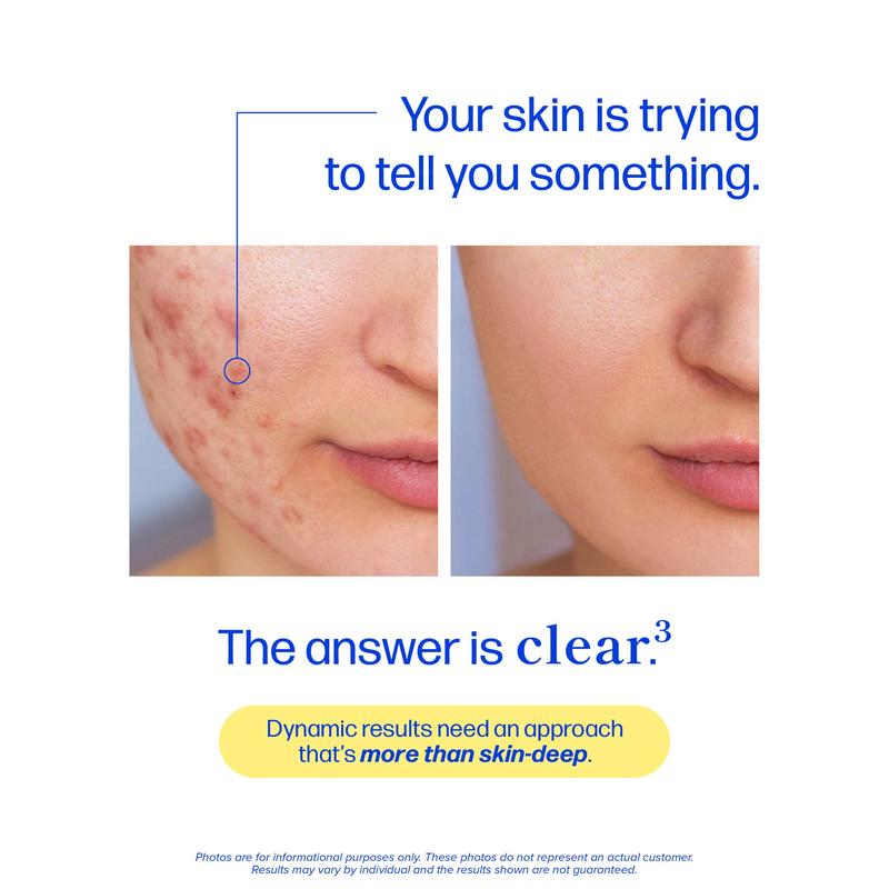 Clear Skin Acne Supplement - Clear Acne From The Source
