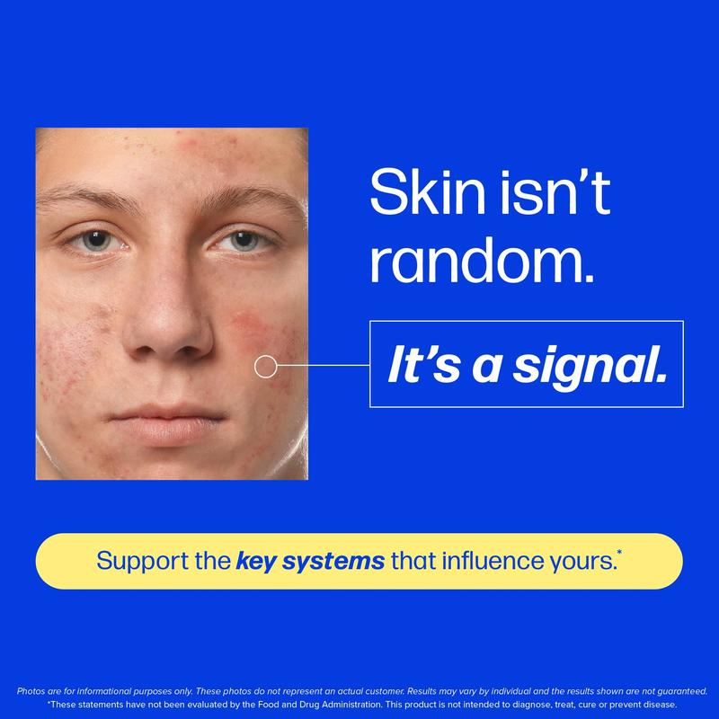 Clear Skin Acne Supplement - Clear Acne From The Source